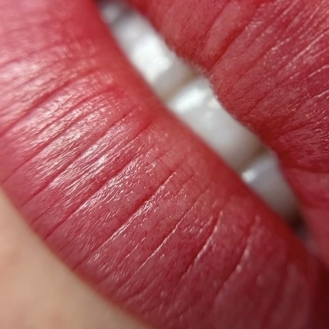 LIPPEN